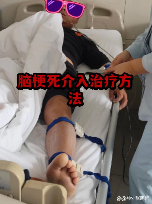 脑梗多长时间可以手术