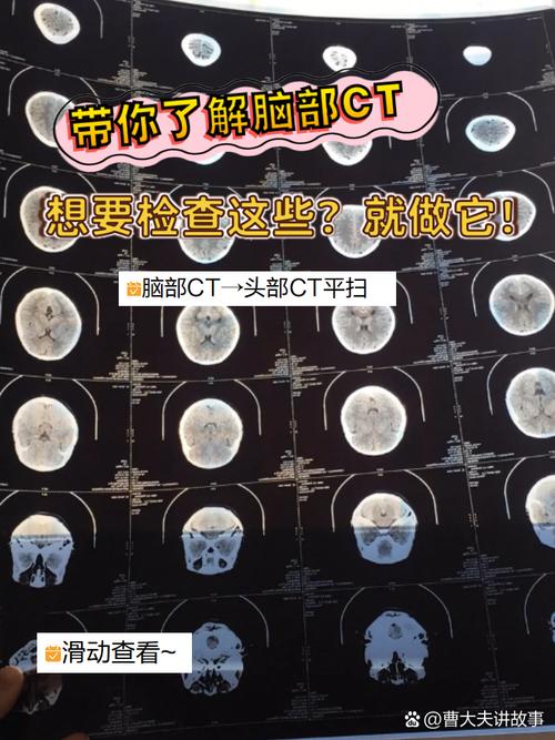 脑梗做ct还是做核磁