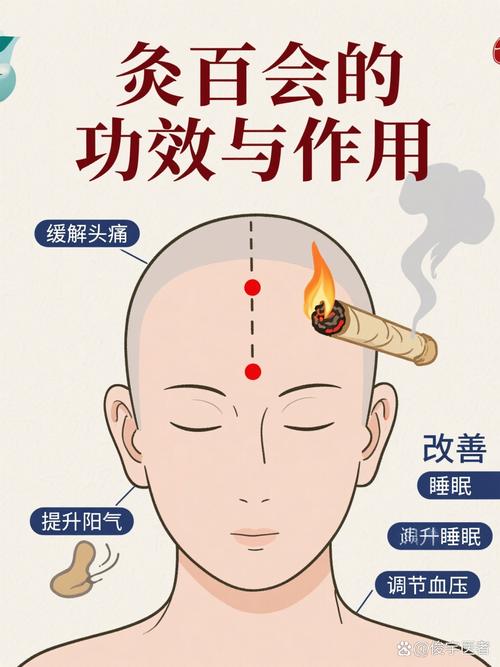 头顶穴位可以艾灸吗