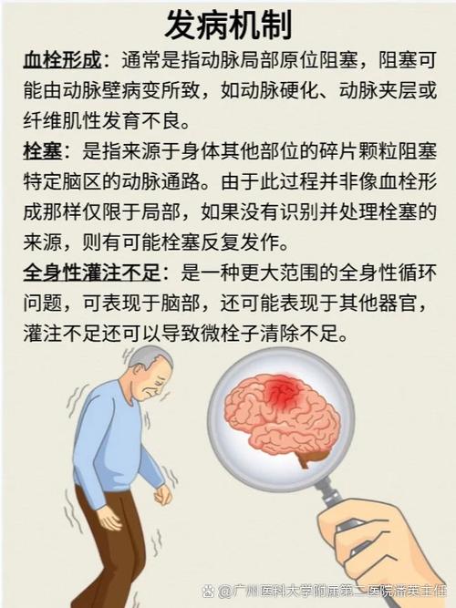 为什么会得脑梗的原因