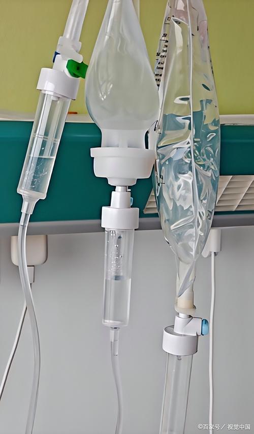 脑梗插胃管要多久拨除