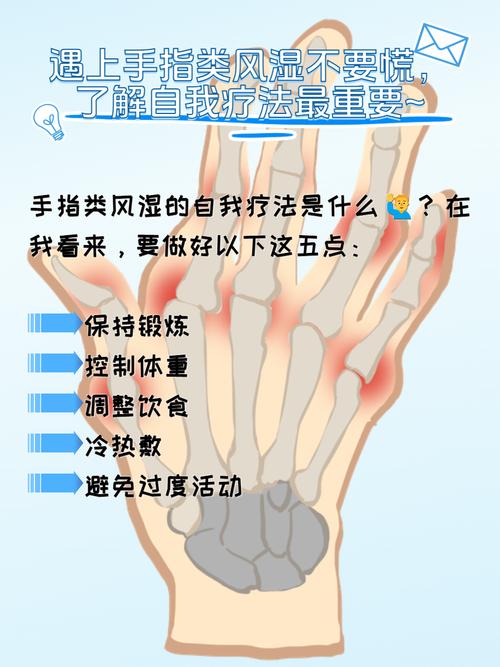 类风湿治疗哪种方法好