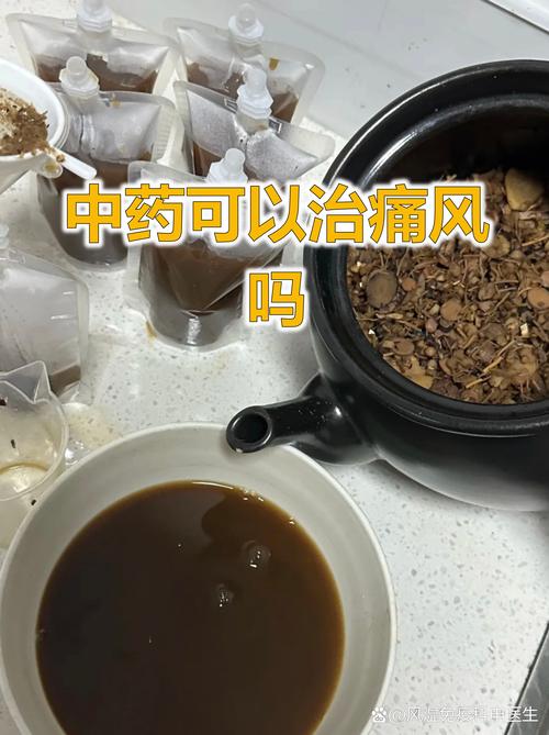 中药治疗类风湿怎么样
