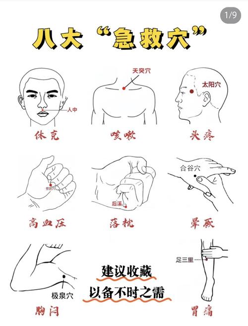 急救有的穴位有哪些
