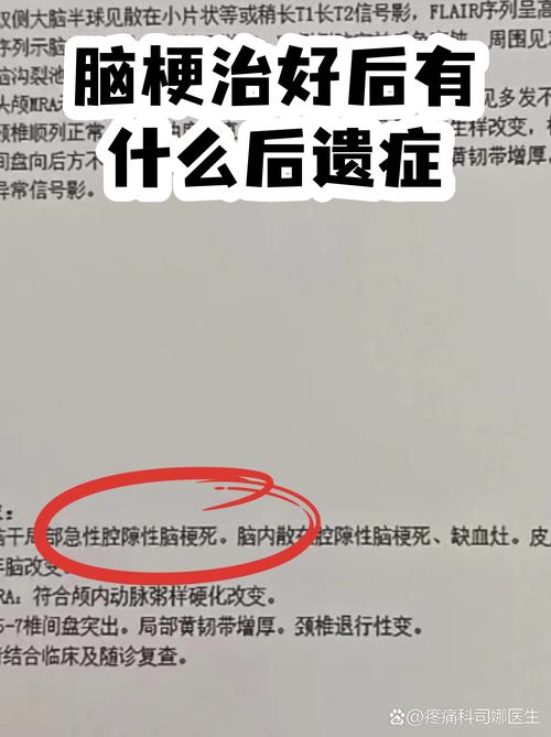 脑梗会有什么后遗症吗