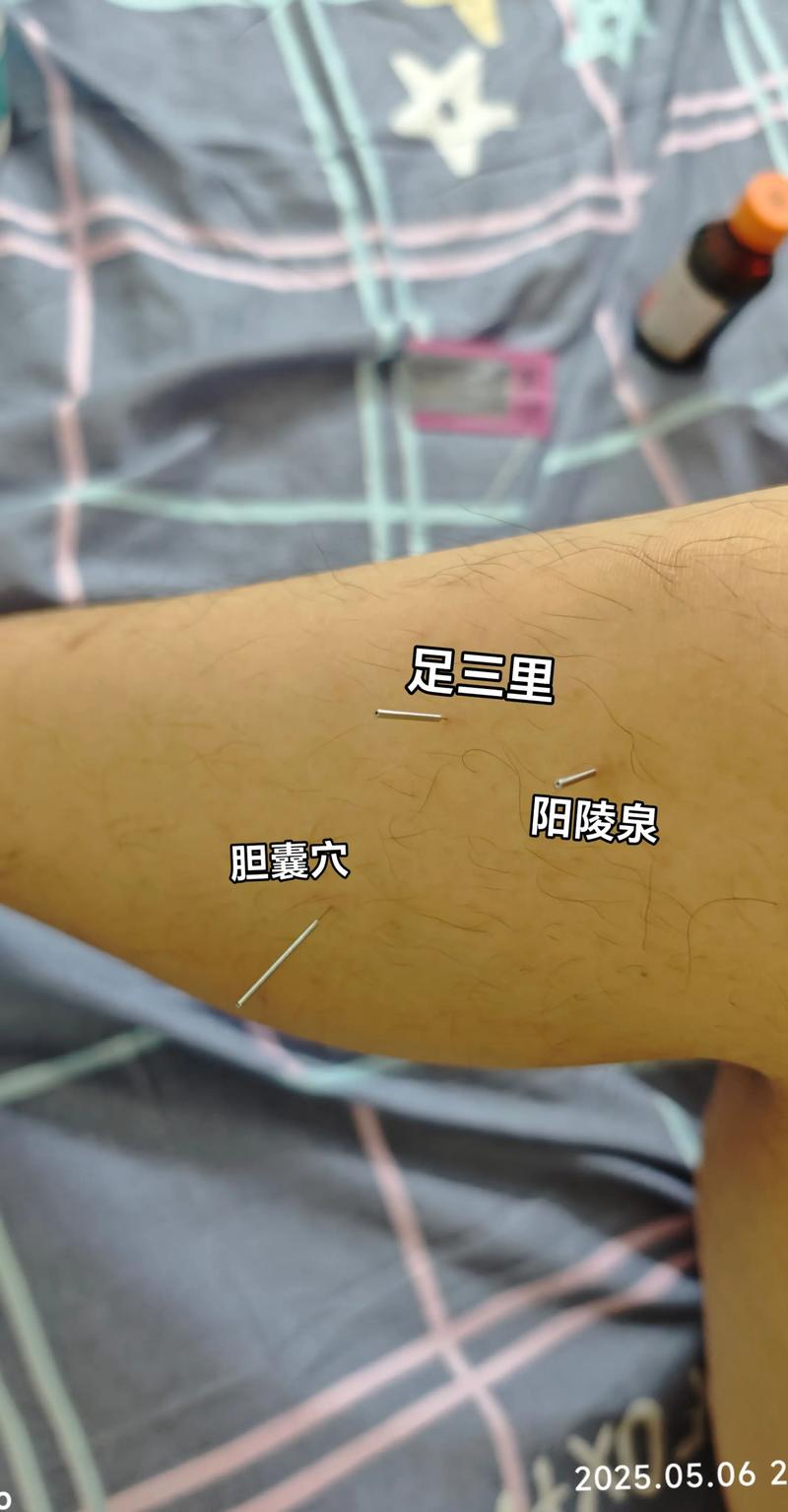 胆囊胆囊穴位位置图