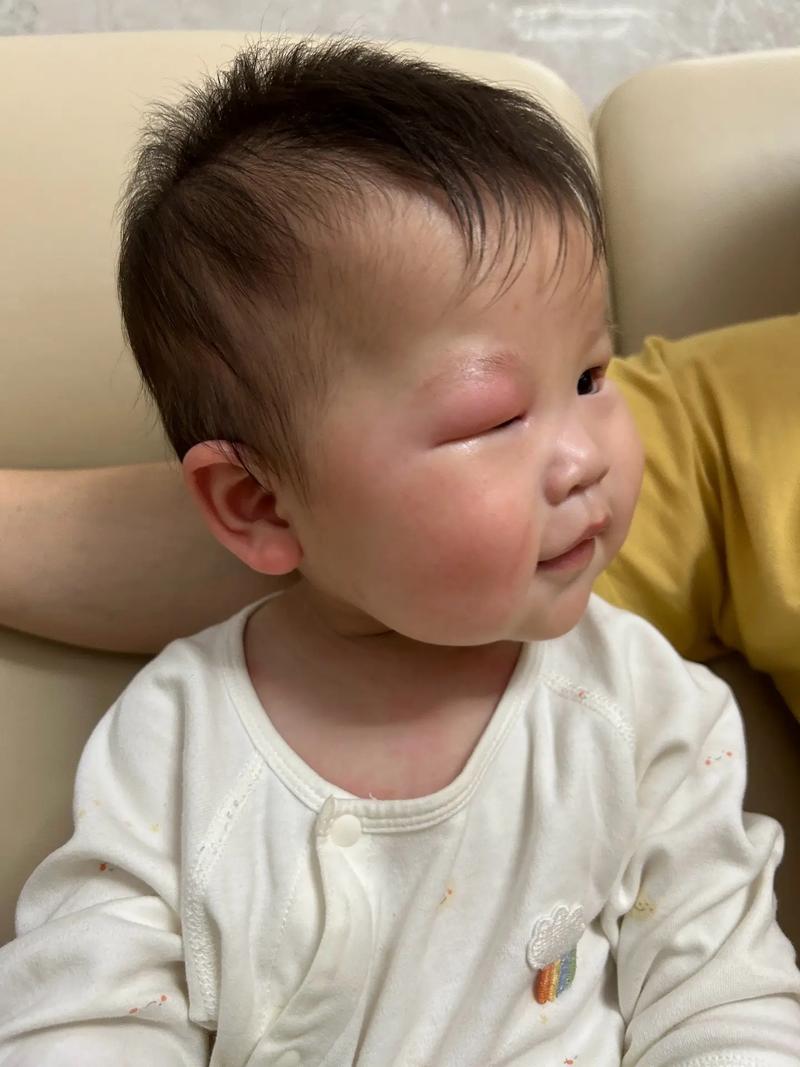 脑梗眼睛睁开没有意识