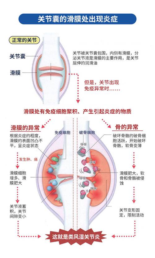 风湿病的基本病理改变