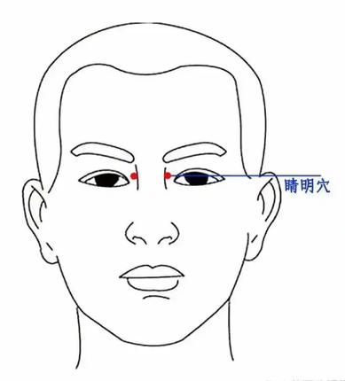 上下睛明穴位怎么找
