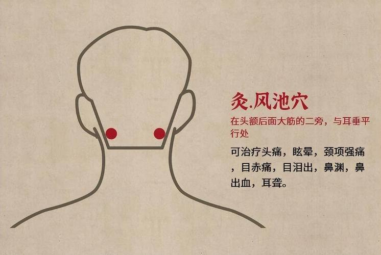 头痛针灸治疗穴位图