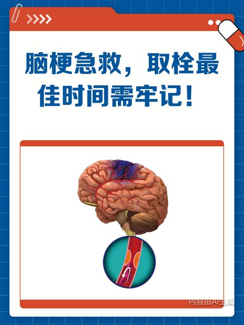 急性脑梗溶栓最佳时间
