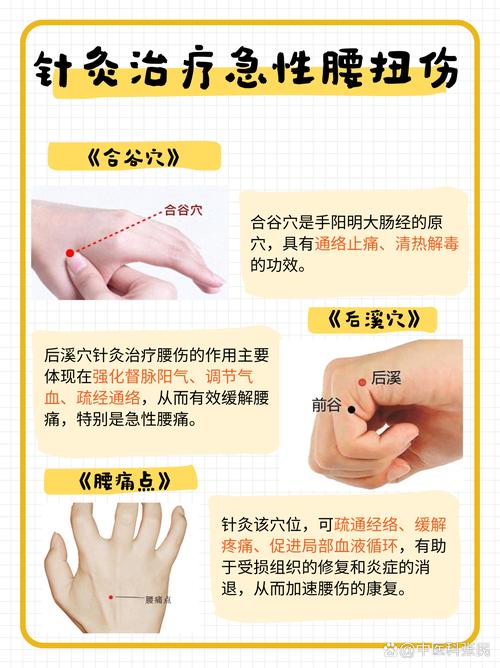 左腰痛针刺右手穴位