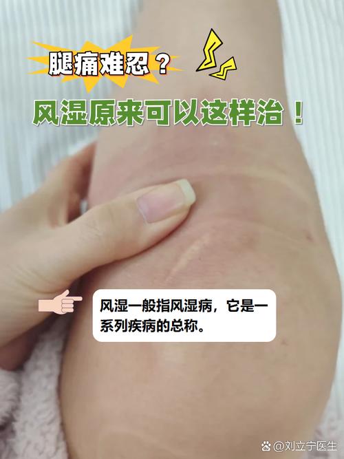 频繁出风湿疙瘩怎么办