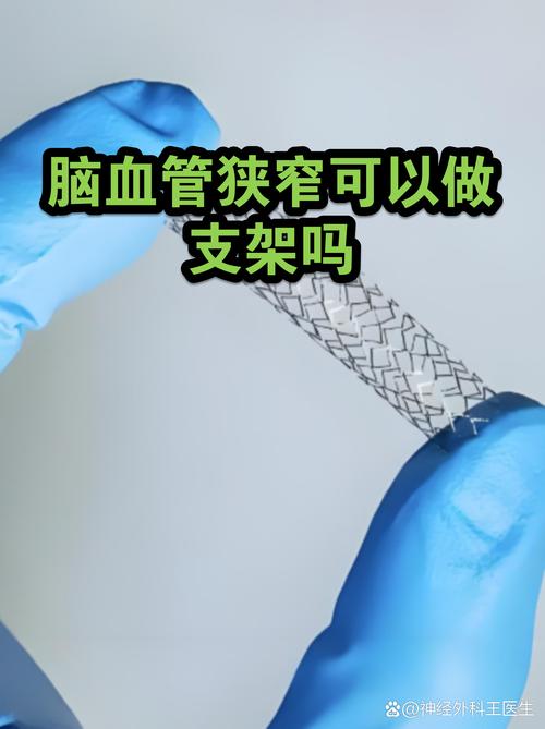 脑梗介入支架手术费用