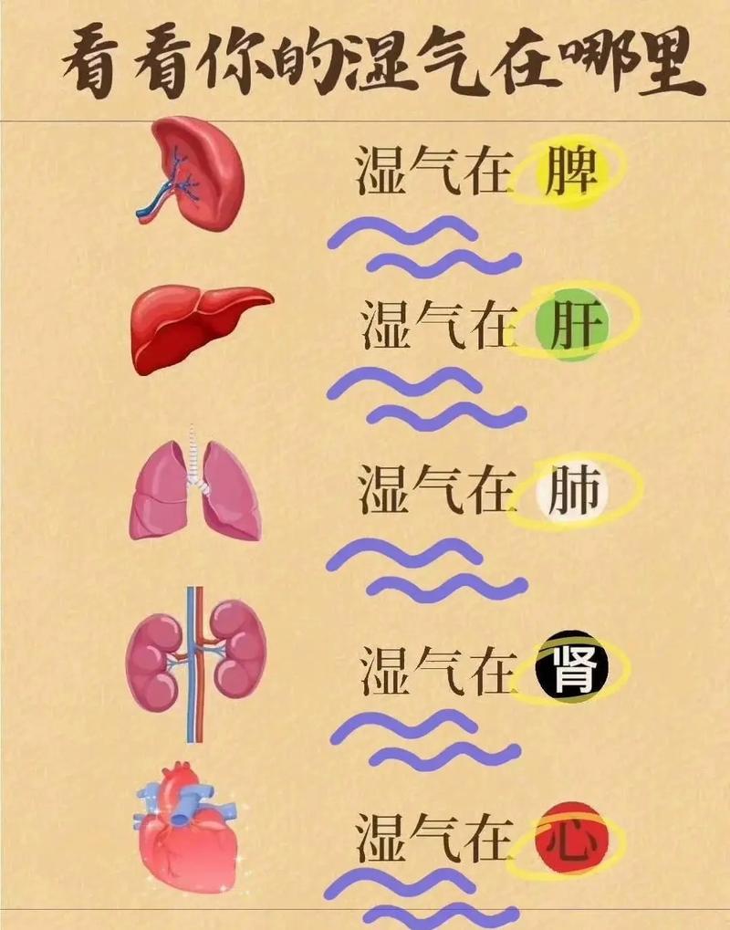 湿气重和风湿有关联吗
