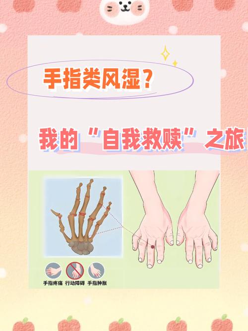 类风湿严重了怎么治疗