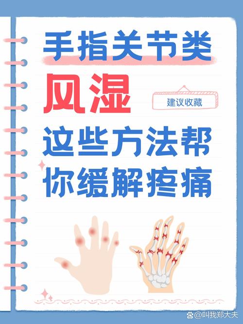 怎么医治类风湿比较好