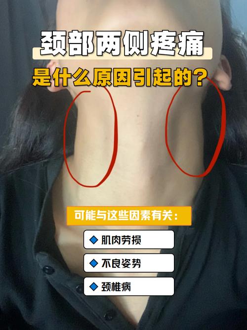 类风湿会脖子疼头疼吗