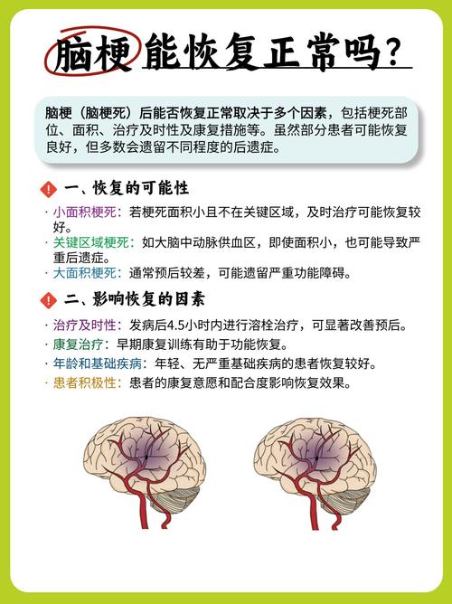 脑梗临终前有什么征兆