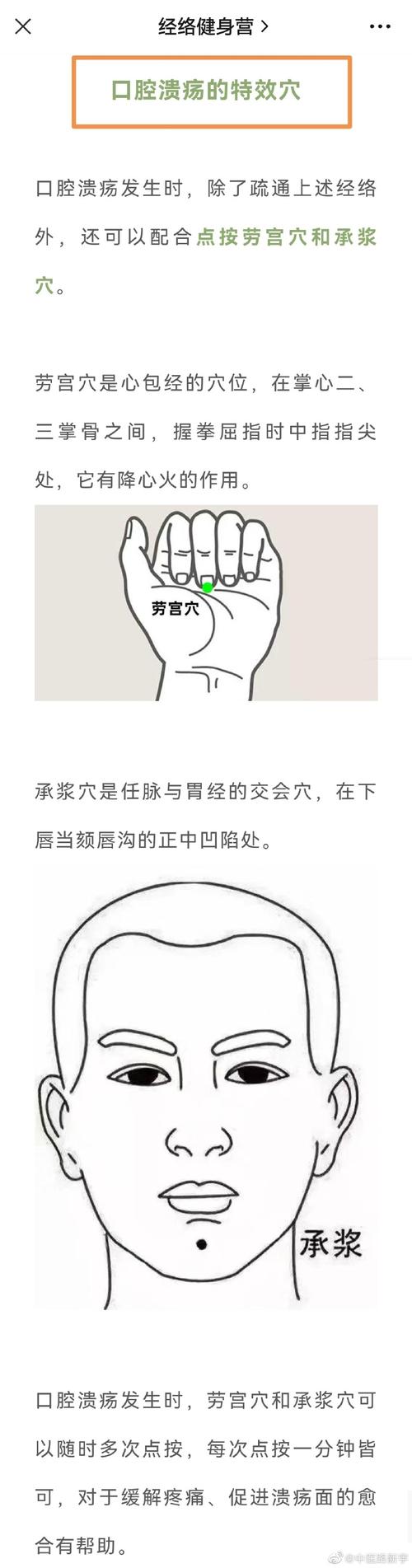 口轻溃疡按什么穴位