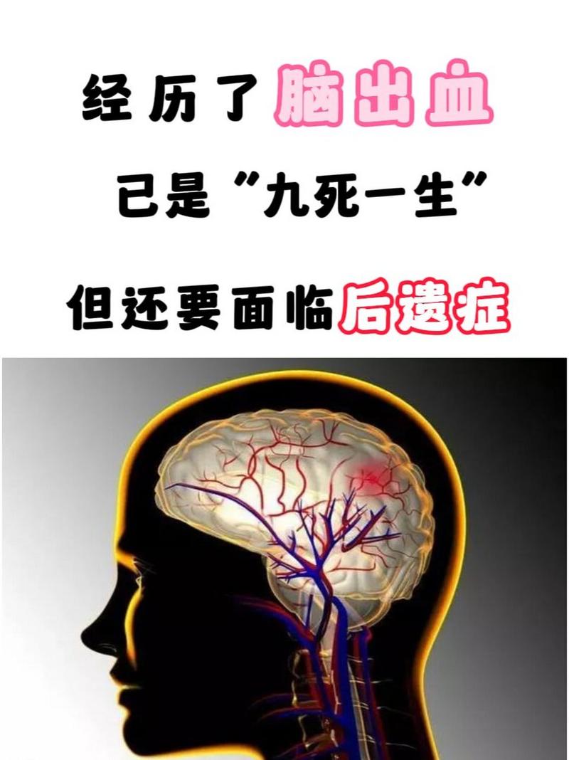 脑梗出血后遗症有哪些