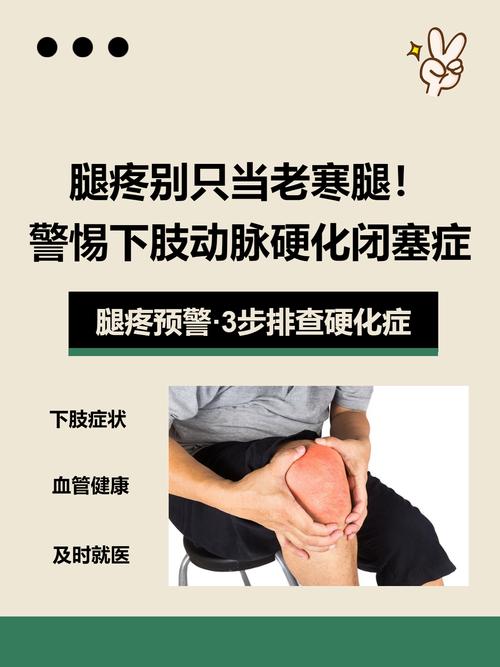 受凉后腿麻木是风湿吗