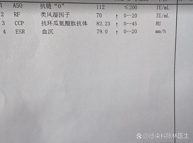 风湿免疫筛查都有哪些