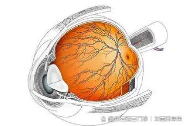 脑梗引起的眼睛看不见