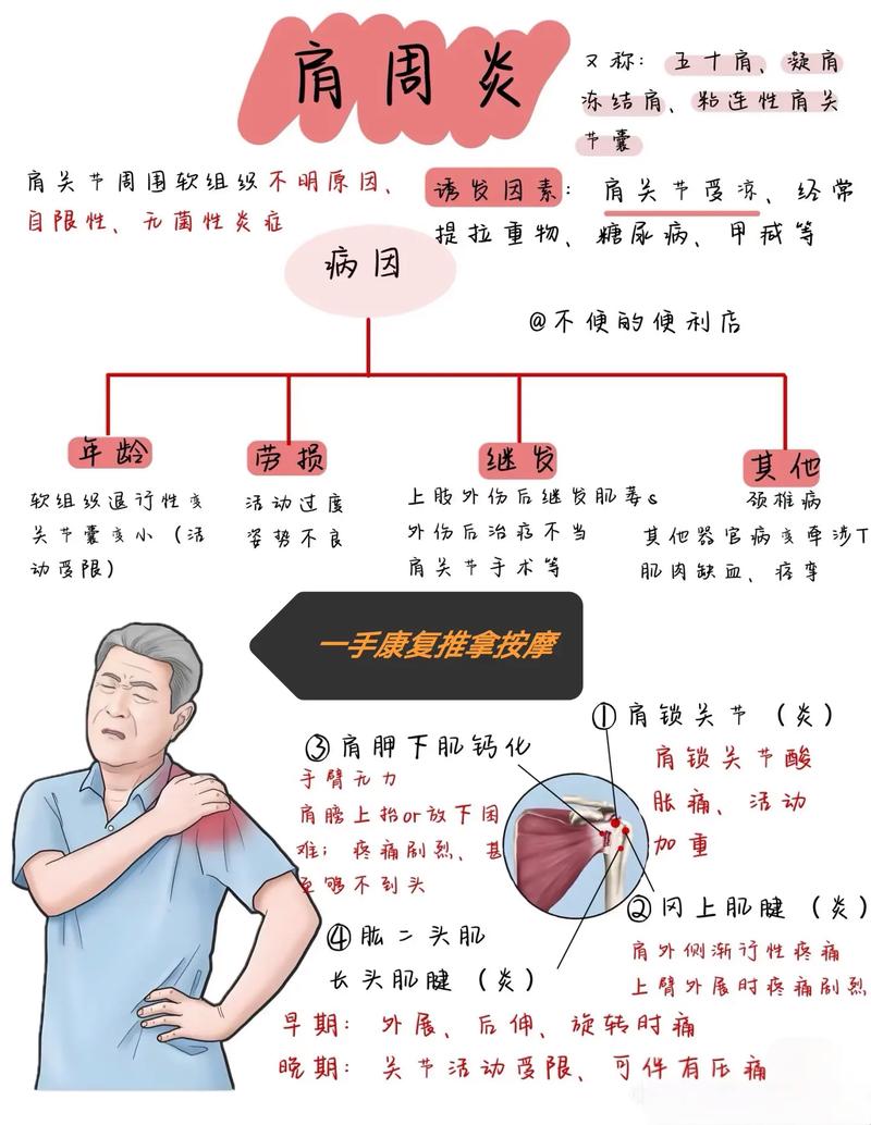 肩周炎与风湿有关系吗