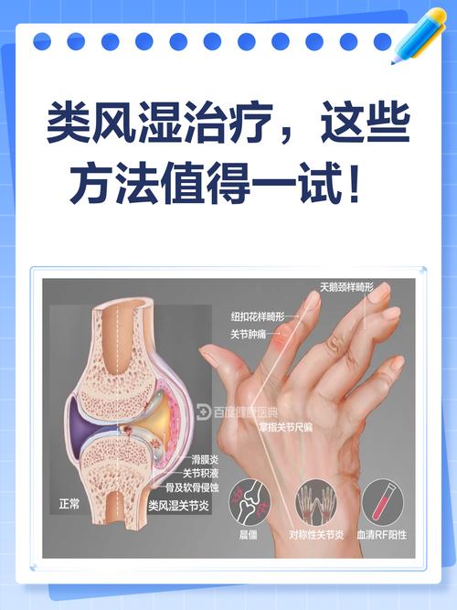 风湿都是怎么引起的吗