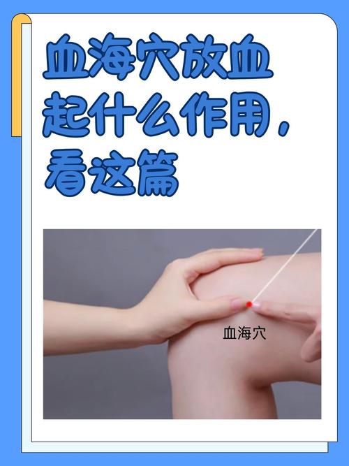 放血疗法的穴位视频