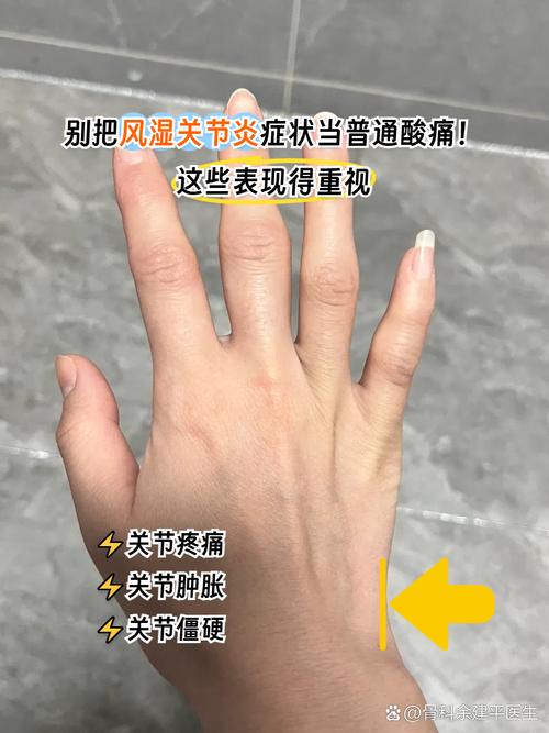 得了风湿的症状是什么