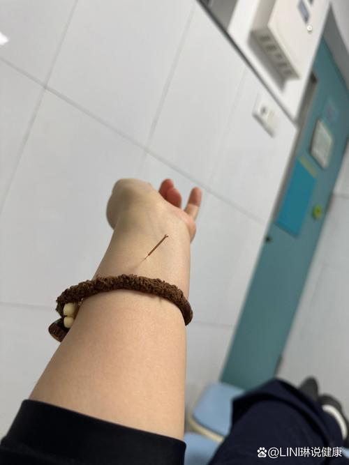 晚上睡不着针灸穴位