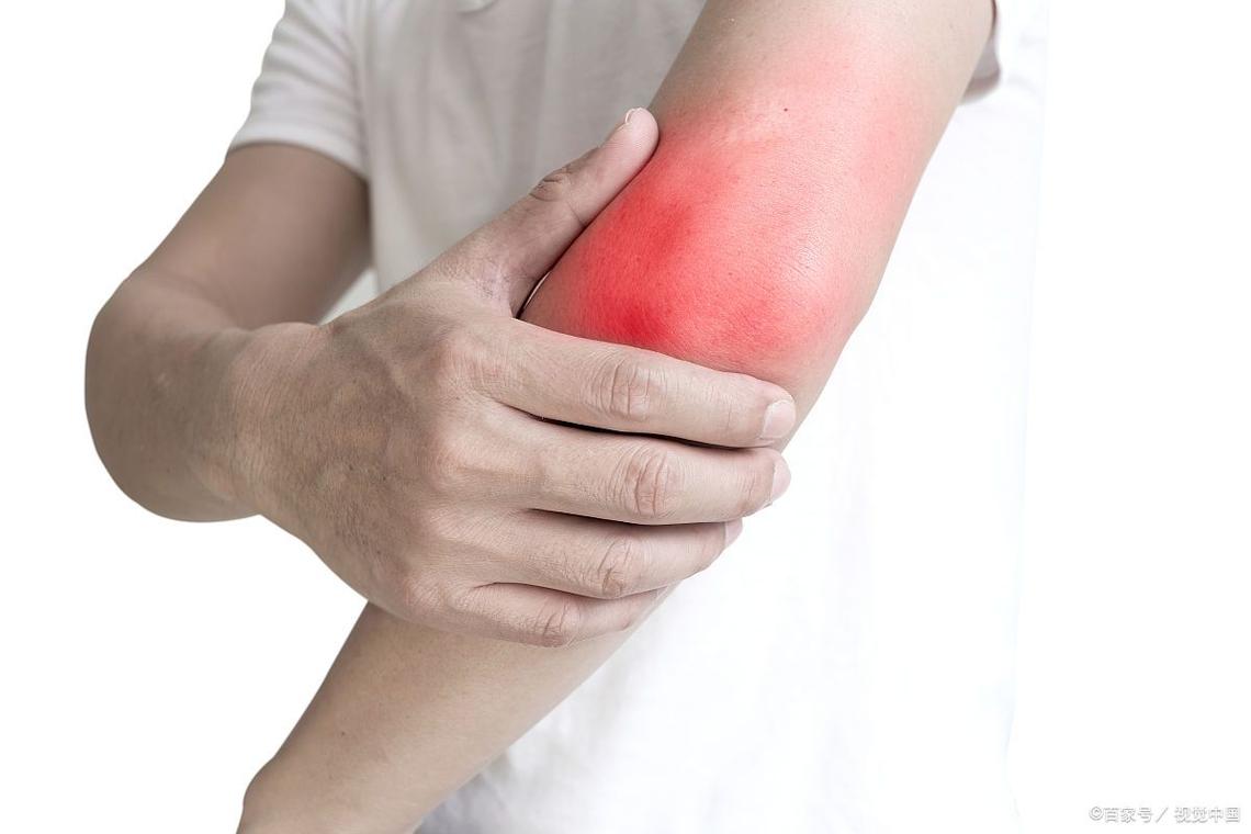风湿胳膊痛背痛的症状