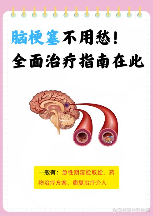 脑梗说话不清怎么治疗