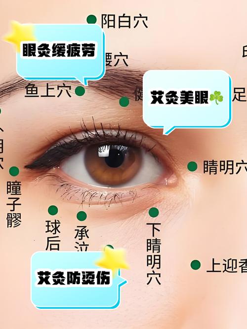 治疗近视眼 穴位