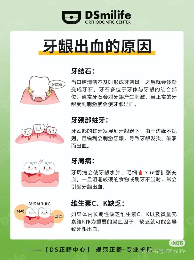 脑梗牙龈出血怎么回事