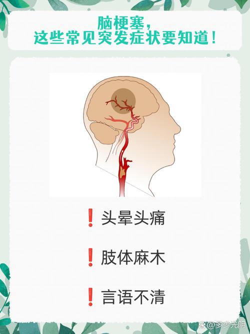 脑梗表现的症状有哪些
