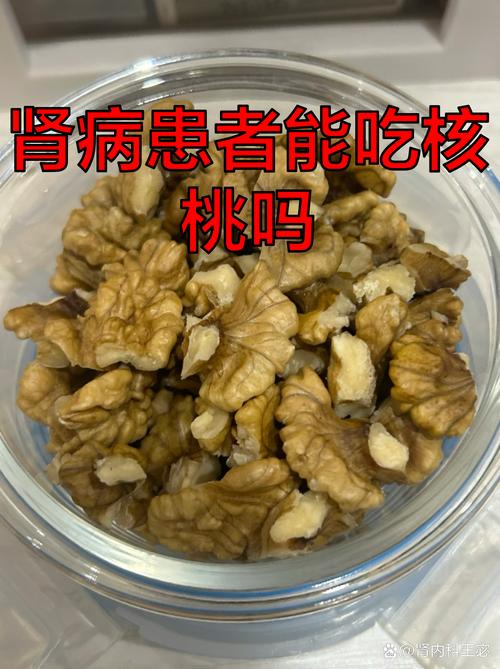 类风湿患者能吃核桃吗