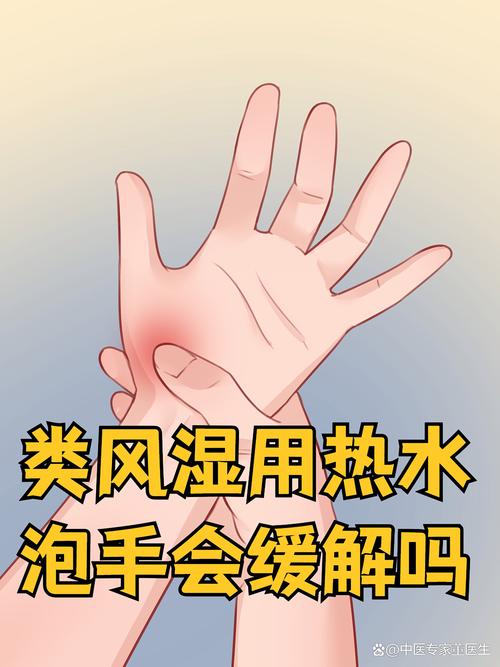 每天洗碗手会得风湿吗