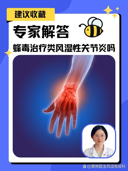 蜜蜂蛰可以治疗风湿吗