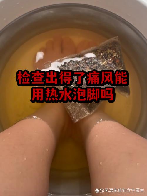 风湿肿用冷水还是热水