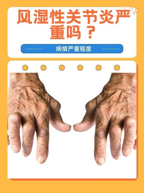 人体风湿是怎样形成的