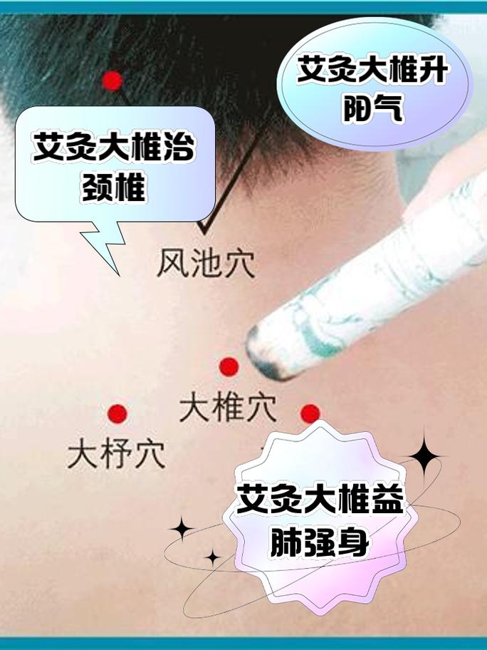 艾灸大椎穴位置出汗
