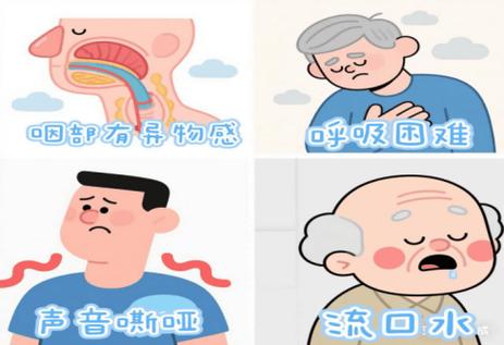脑梗病人吃饭吞咽困难