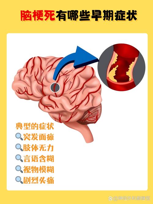脑梗为什么会肺部感染