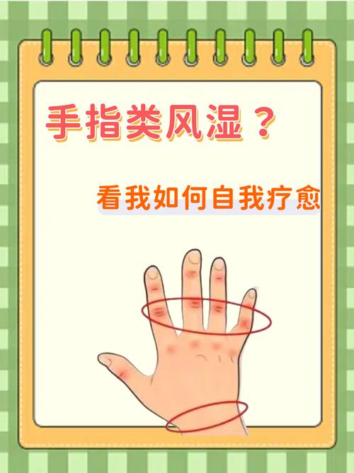 类风湿怎样能快速消肿