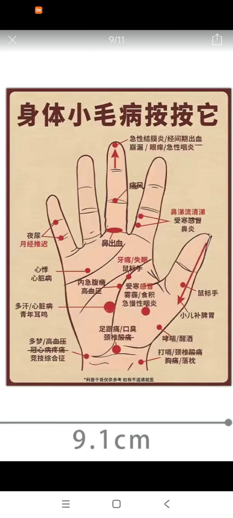 人体手上穴位高清图