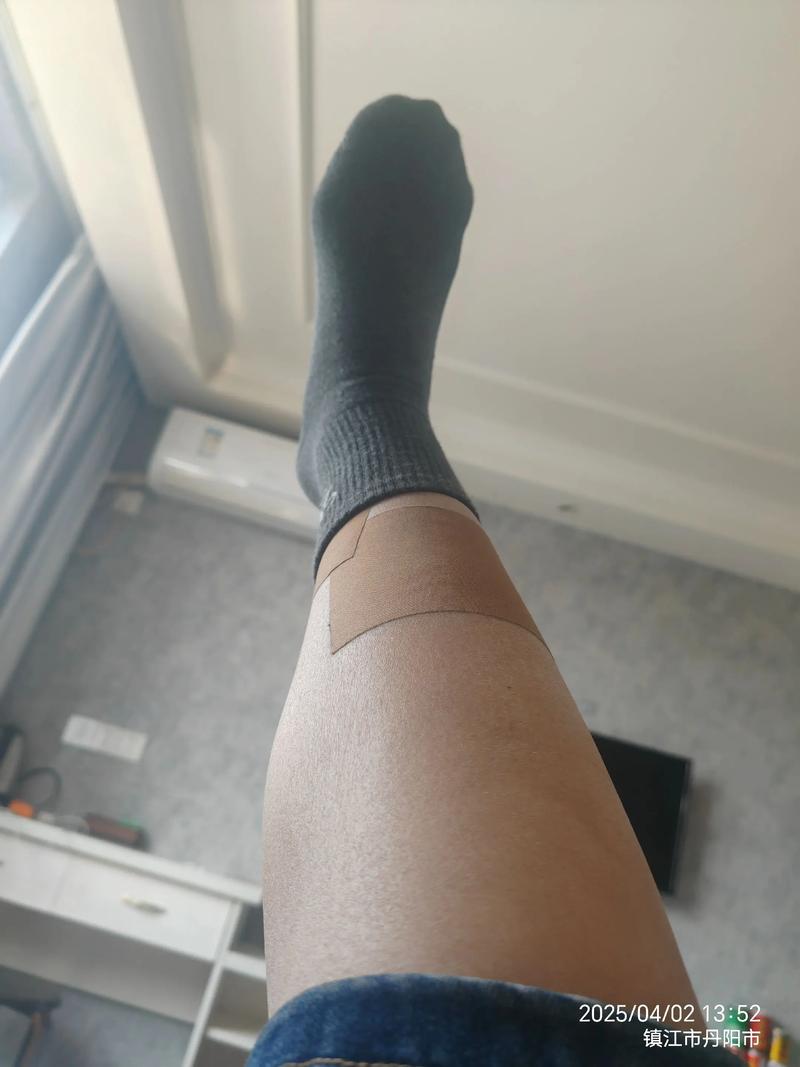 小腿贴风湿膏位置图片