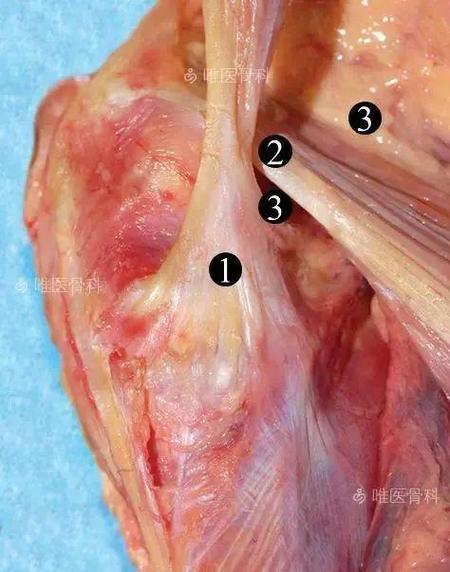 类风湿引起腿部长囊肿